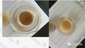 血浆蛋白制品，血浆补蛋白好,还是白蛋白补蛋白好